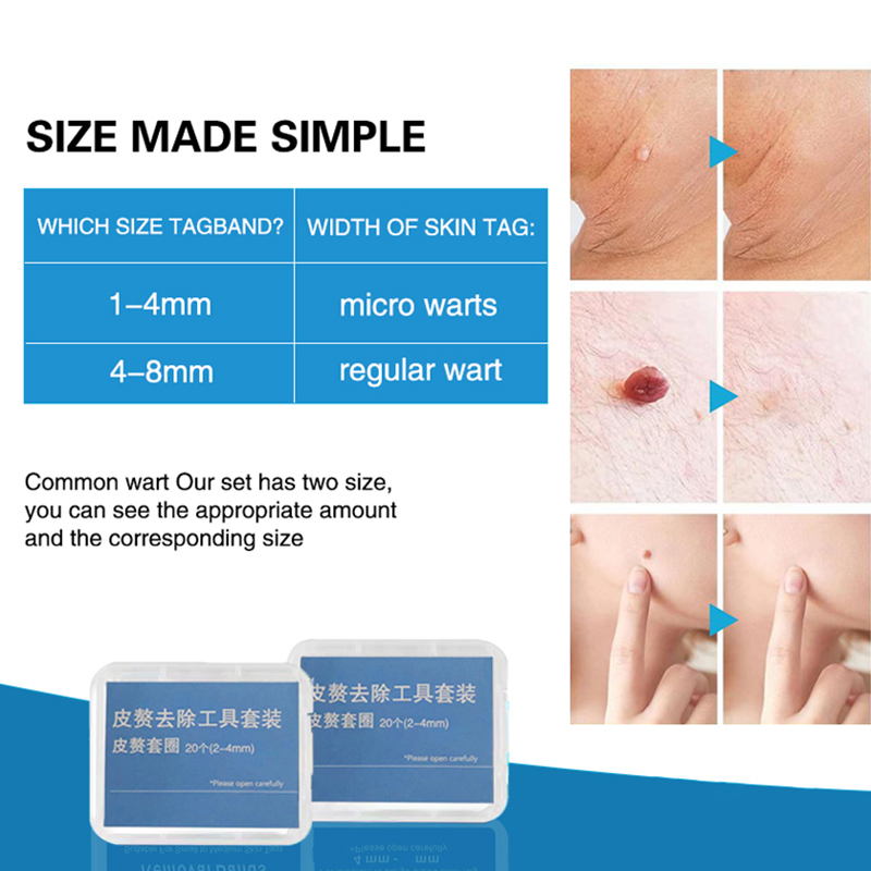20pcs/Box Flesh Nevus Removal  - Power Tools Total review and price